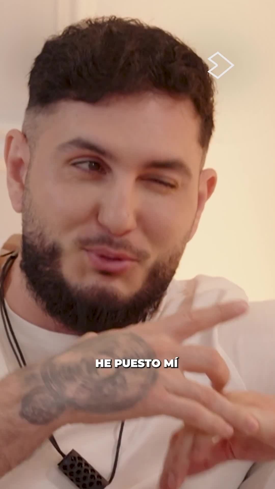 Carlos confiesa: se puso ácido en labios sin que su familia lo supiera y lió con actor de 'Élite'