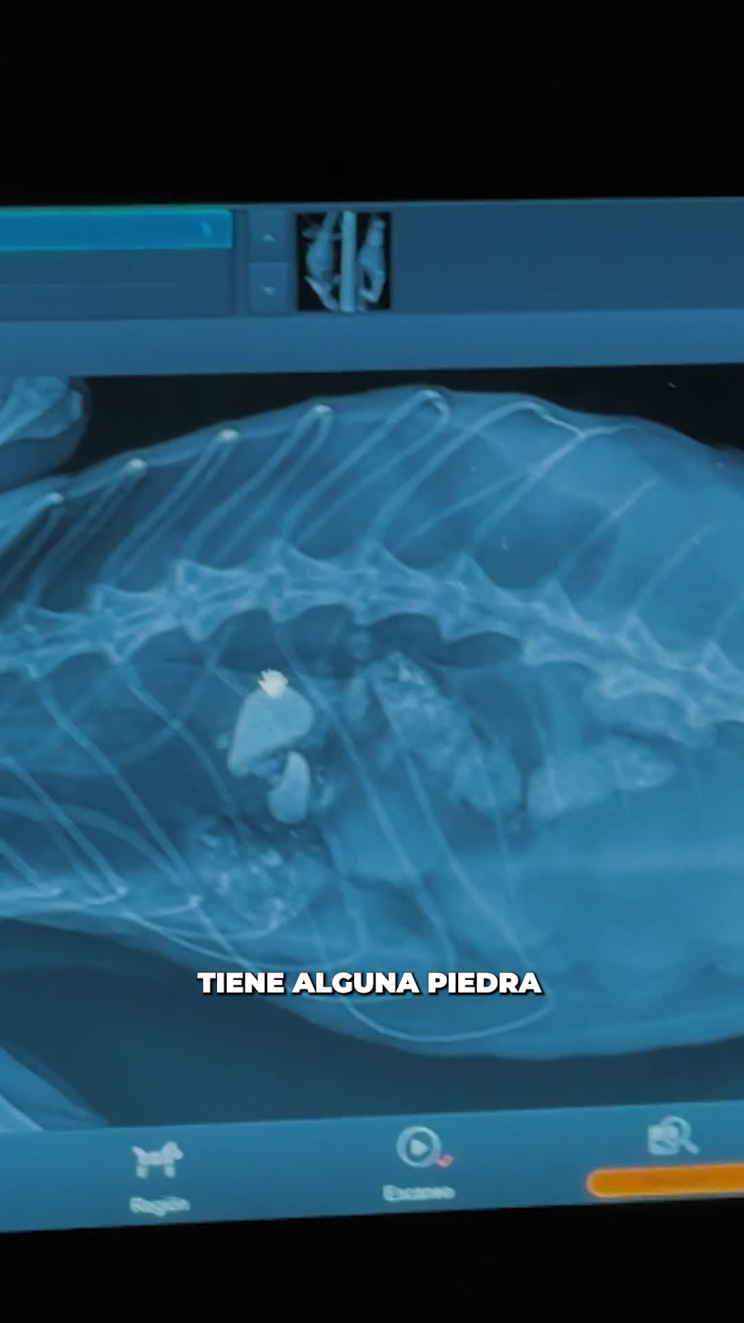 🩻👀 Es increíble todo lo que se puede descubrir en una radiografía