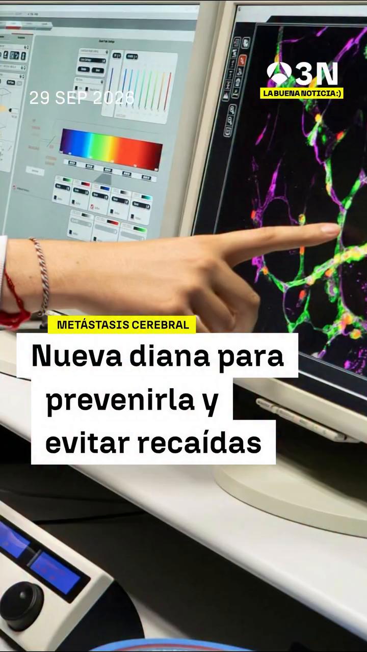 🔬 Investigadores españoles descubren una fase vulnerable de la metástasis cerebral que podría ayudar a prevenirla