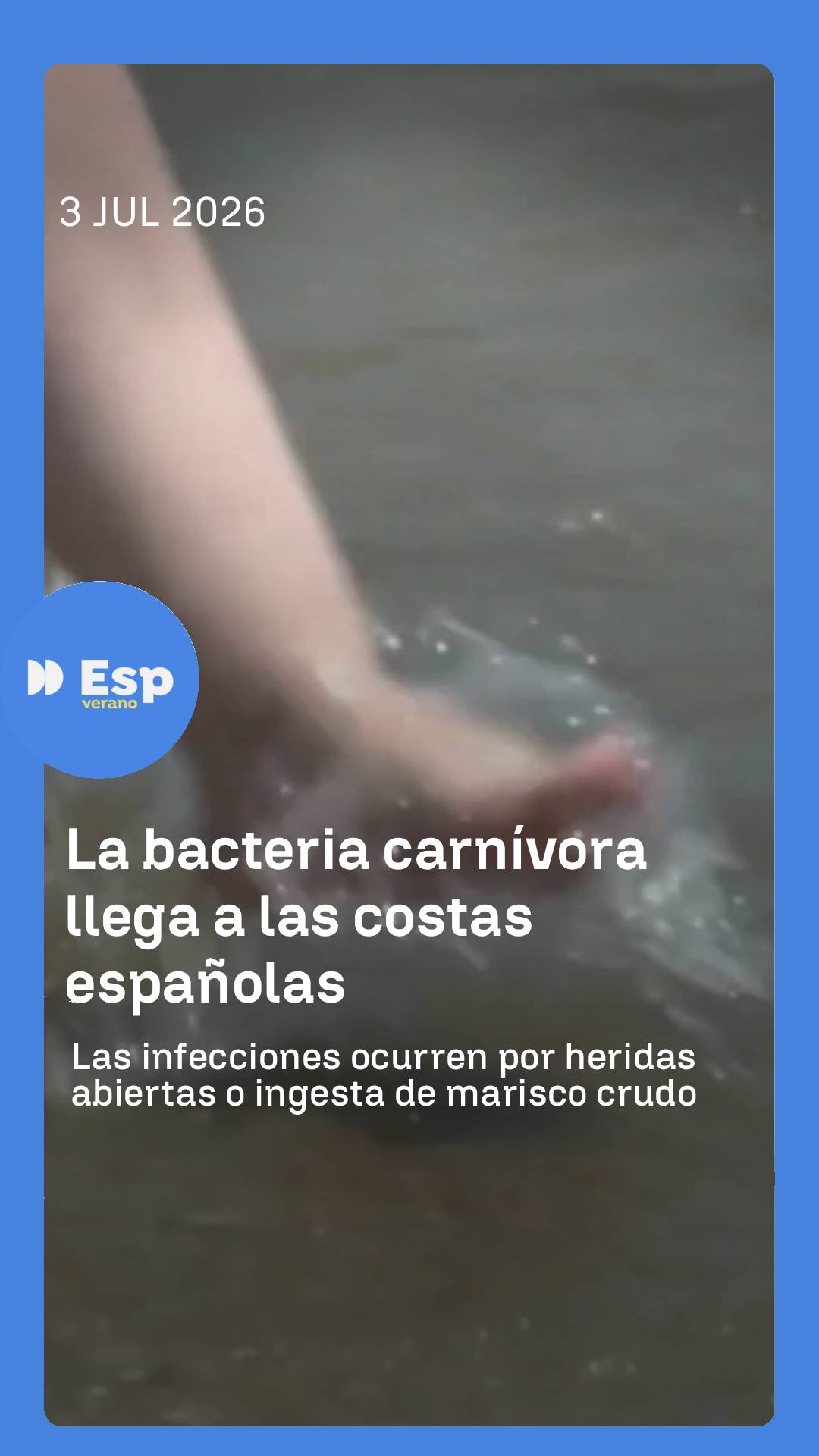 🦠 El 'Vibrio vulnificus' es la bacteria carnívora que puede suponer un problema en las playas del mediterráneo este verano.