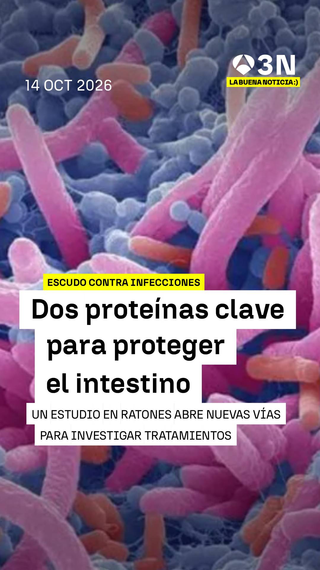 🧬 Descubren el papel clave de dos proteínas para proteger el intestino frente a infecciones graves