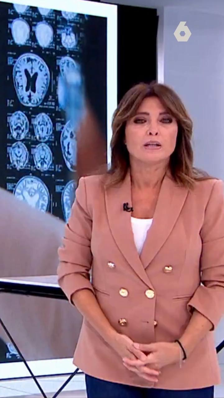 Es el tumor cerebral más agresivo y frecuente.
