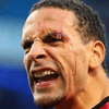 Ferdinand se hace millonario