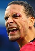 Ferdinand se hace millonario