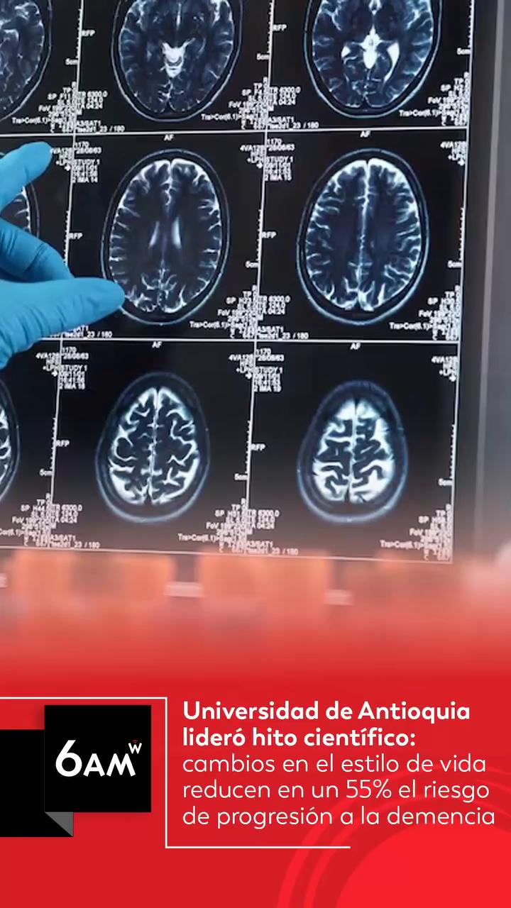 Expertos recomiendan iniciar hábitos saludables desde los 20 años para reducir riesgo de demencia