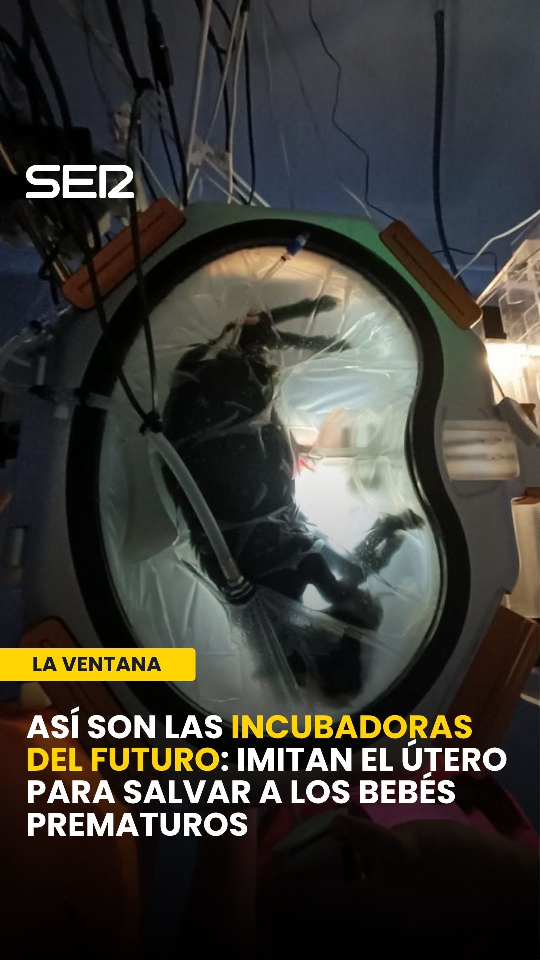 Dispositivo con líquido amniótico replica el útero para prematuros