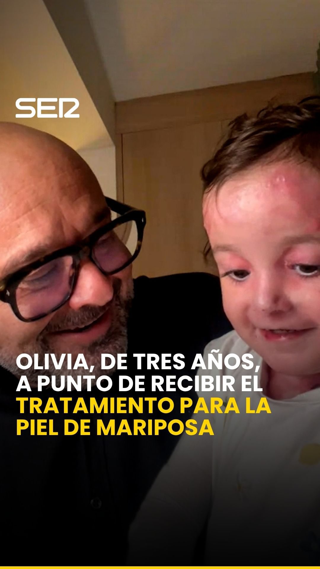 Los padres de Olivia normalizan su enfermedad rara para que tenga una vida plena