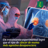 Un tratamiento experimental logró que el tipo de cancer de mama más agresivo desapareciera