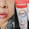  ¡¡ALERTA @DigGemaps!! Emite alerta de seguridad en pasta dental Colgate Total Clean Mint con presencia de Fluoruro de Estaño  | NO use este producto