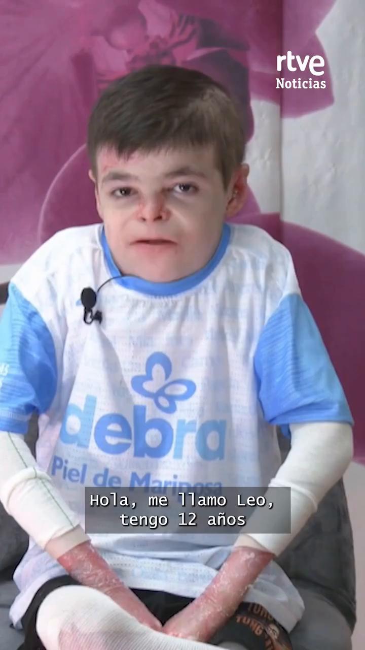 Leo, el niño sevillano de 12 años con piel de mariposa, reclama al Gobierno la aprobación de su medicamento