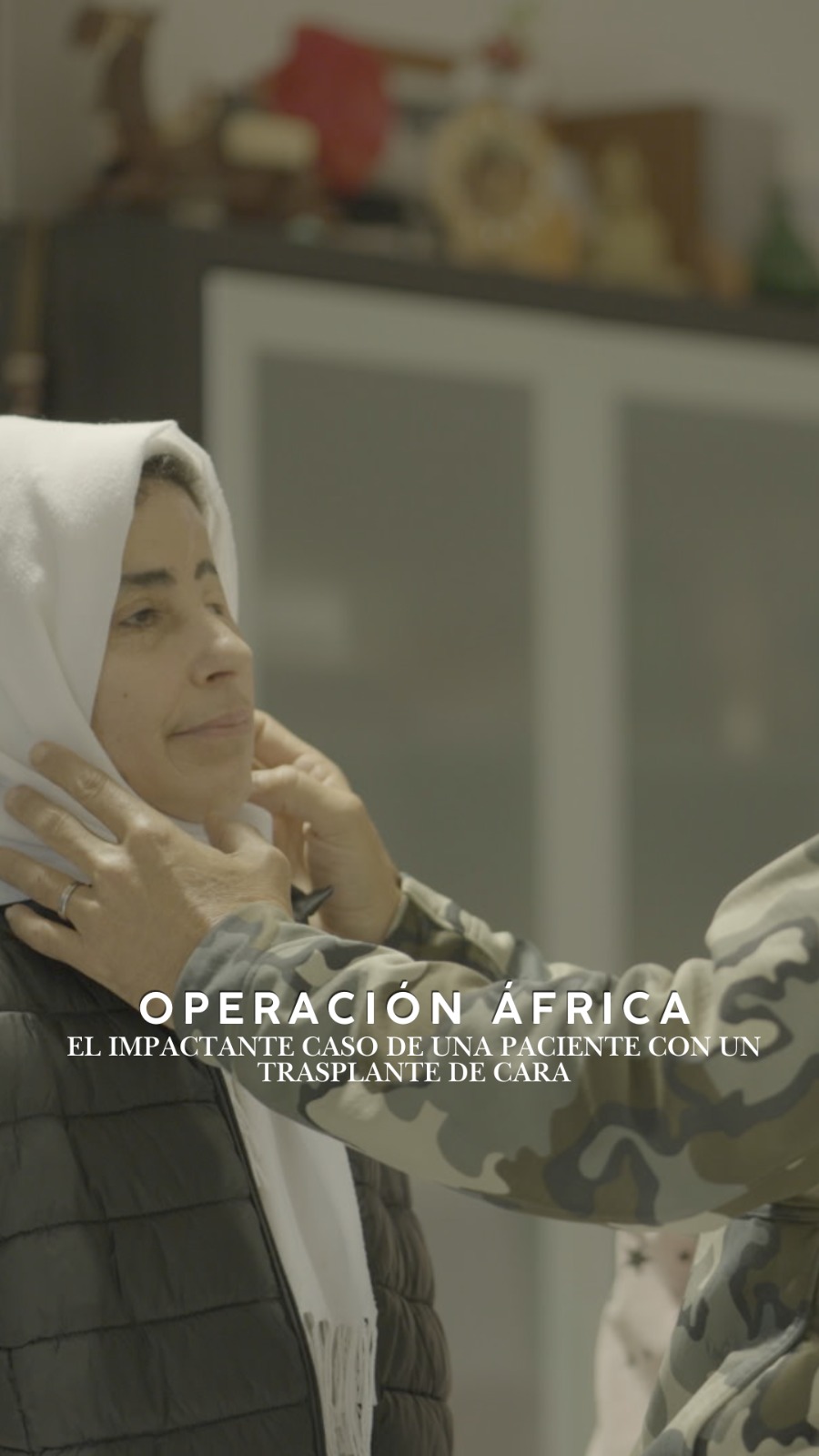 Médico evalúa prótesis ocular de paciente con quemaduras faciales graves