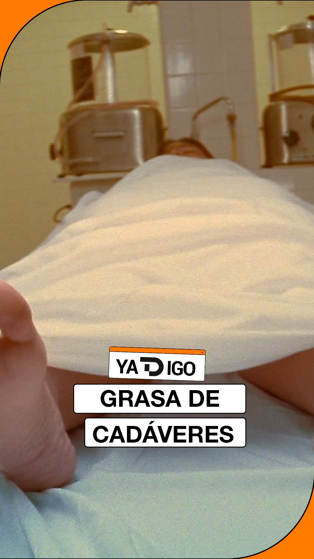 Inyectarse grasa de cadáveres: la tendencia beauty de 2026 tras Ozempic