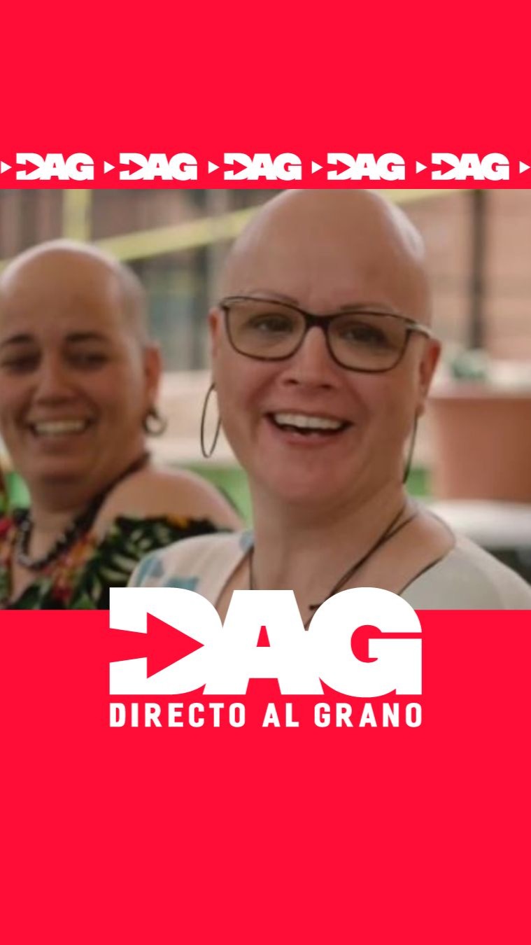 Conchi perdió todo su pelo en semanas: la alopecia universal que destruye identidades