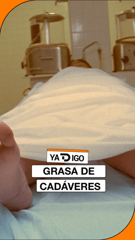 #YaTDigo Inyectarse grasa de cad�veres para rellenar la flacidez de la carne provocada por un r�pido adelgazamiento con Ozermpic o simplemente para tener un pecho o un trasero prominentes sin recurrir a pr�tesis.
