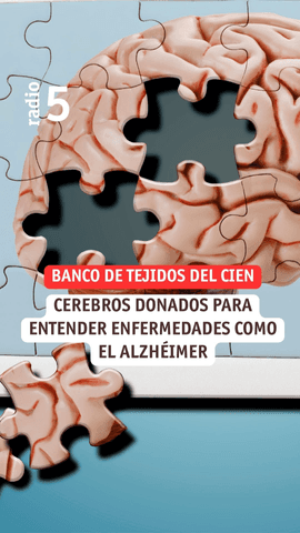  ¿Sabías que un cerebro donado puede ayudar a investigar enfermedades como el Alzhéimer?